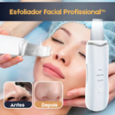 Esfoliador Facial Profissional